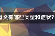 胃炎有哪些類型和症狀？