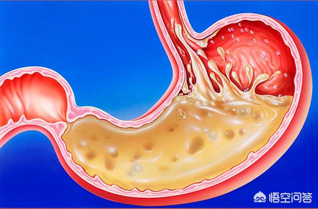 胃不好有什麽(me) 症狀?胃病常見病因及症狀是什麽(me) ?該如何治療和護理<strong>胃病</strong>？