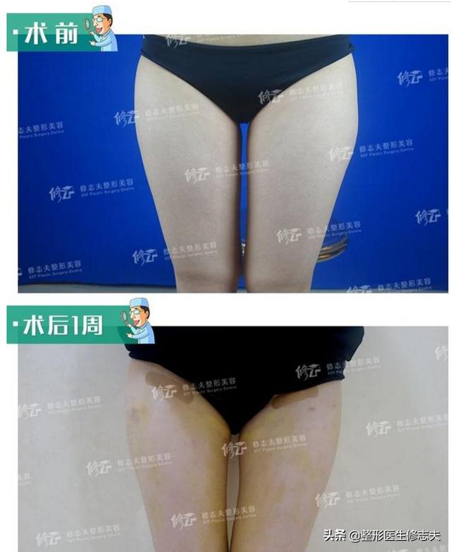 快速減肥的方法有哪些<strong>減肥方法</strong>？