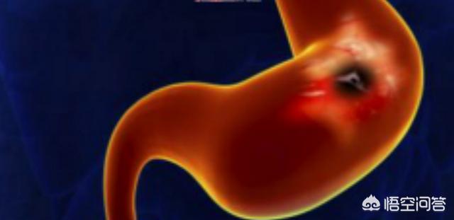 餓的時候吃健胃消食片會(hui) 對減肥有用嗎<strong>健胃</strong>？