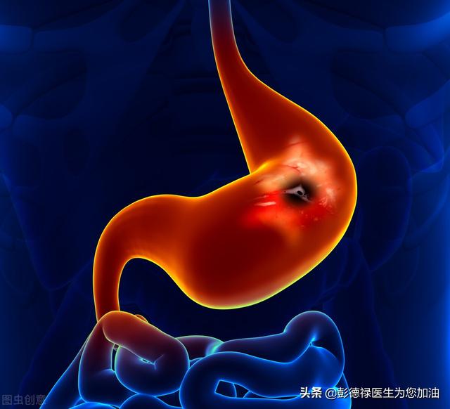 患上胃潰瘍的症狀是什麽(me) <strong></p>
<p>胃潰瘍</strong>？