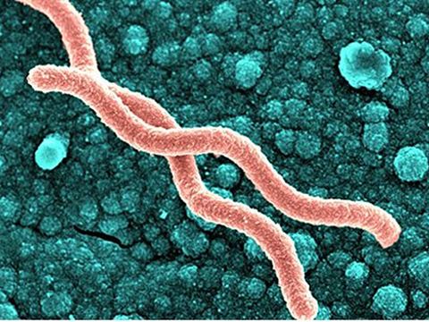 正常人幽門螺旋杆菌值是多少幽門螺旋杆菌的標準是多少